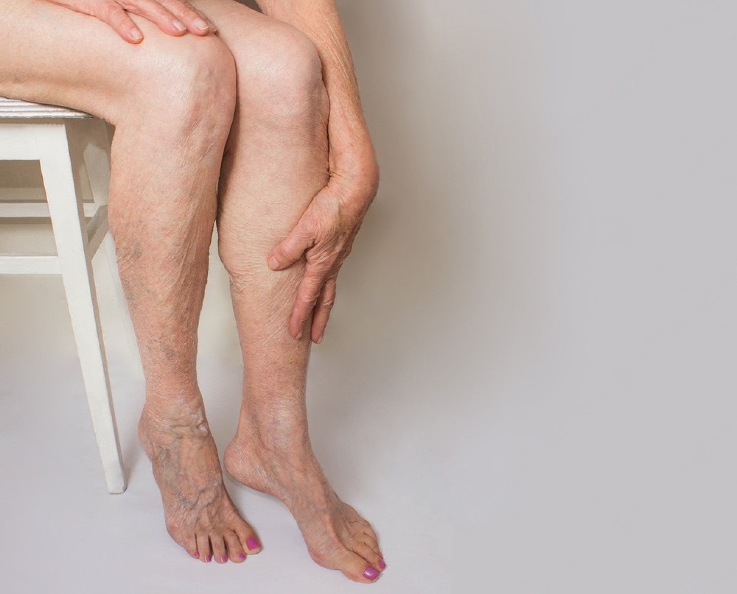 Colorado Varicose Veins Treatment