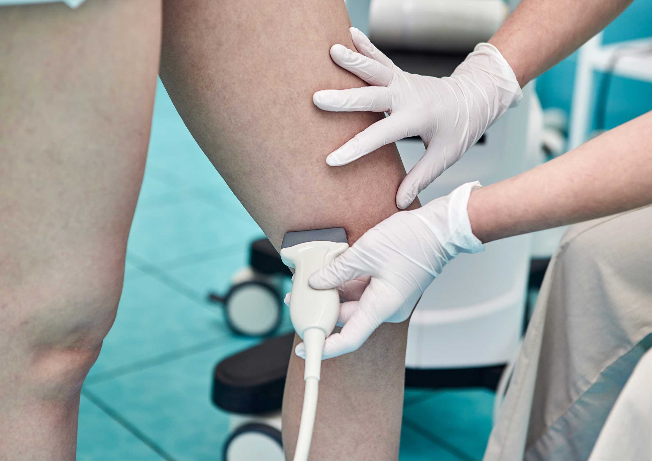 Chronic Venous Insufficiency Specialist - Dallas, TX & Hurst, TX: Texas  Vascular Institute: Varicose Vein Specialist