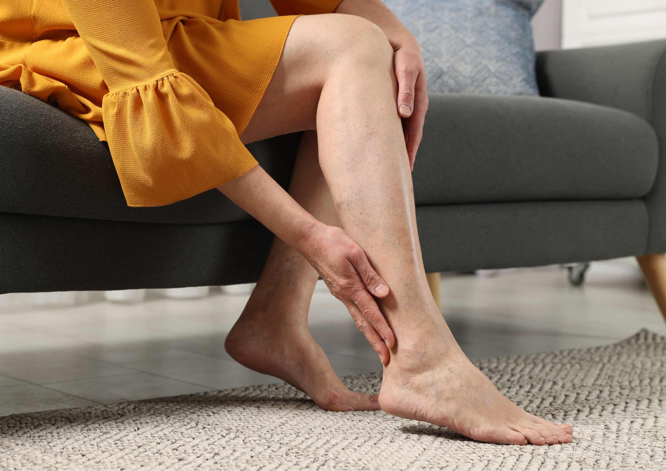 Photo - 3 - Varicose Veins in Hurst: Expert Care at Your Doorstep