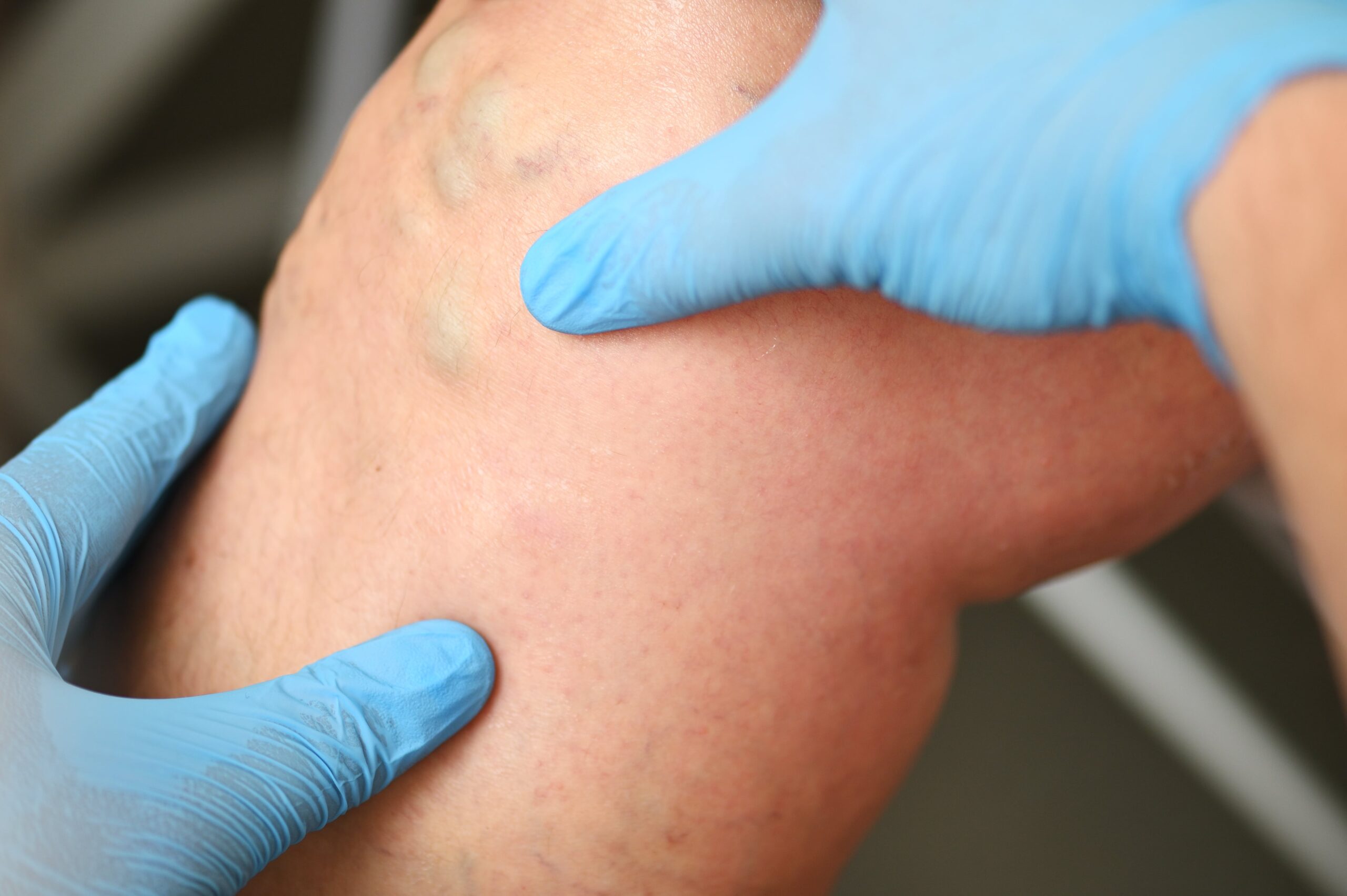 Photo - 1 - Vein Specialist in Garland, TX