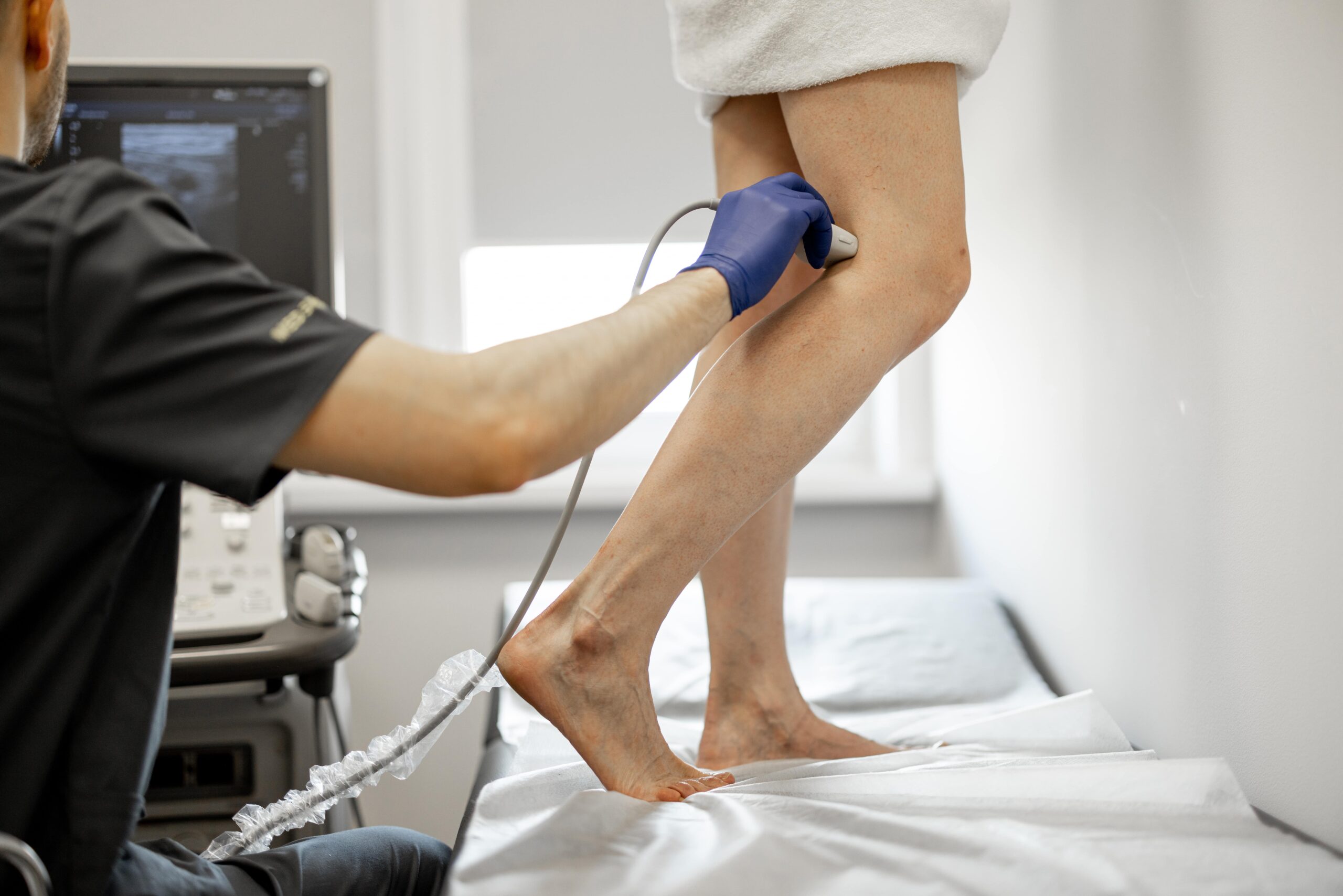 Photo - 0 - Why Do I Have Bulging Leg Veins Without Varicose?