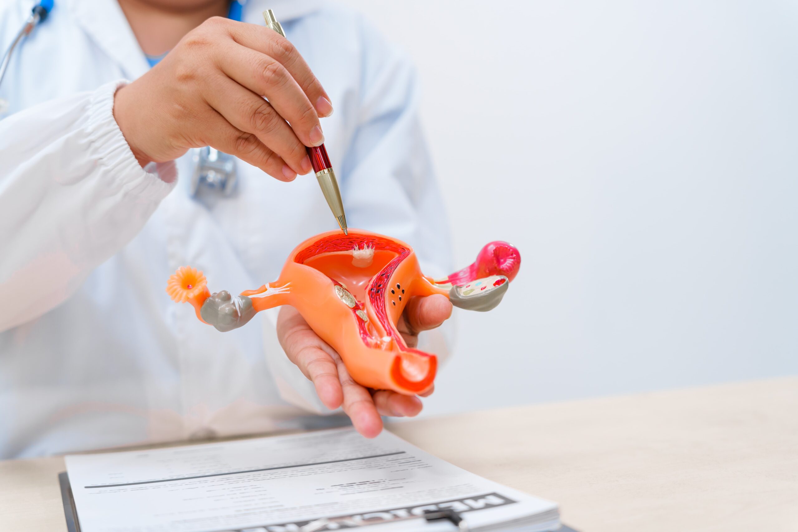 Photo - 0 - Embolization Procedure